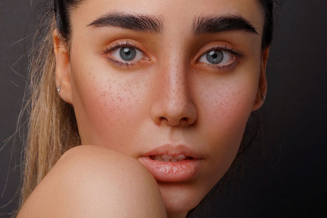 Skin Barrier Protection: What Is It?