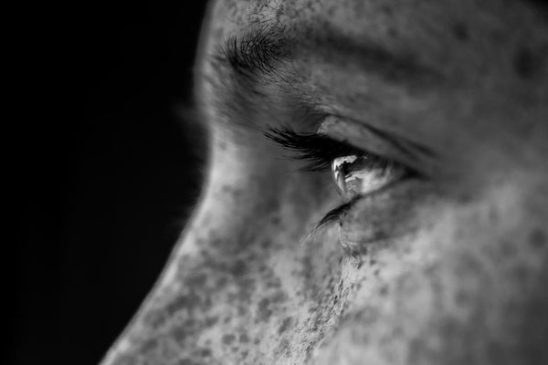 Ingredients Watch: Tranexamic Acid