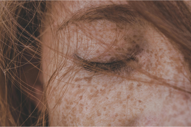 A Guide To Skin Pigmentation In Winter