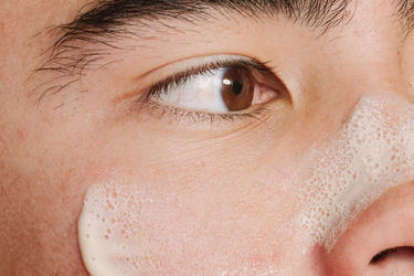 how to get rid of blackheads routine