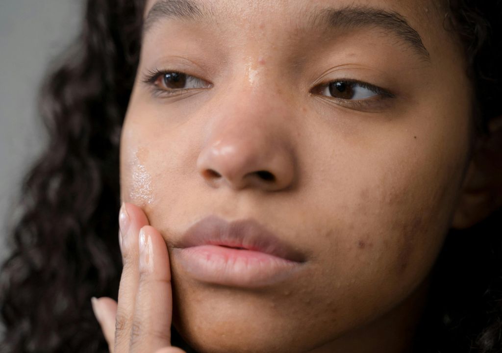 Introducing SOME BY MI Skincare: Natural Korean Skincare For Blemishes, Acne, And Unbalanced Skin
