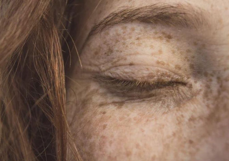 makeup free lady with freckles