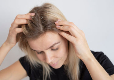 Lady with dandruff