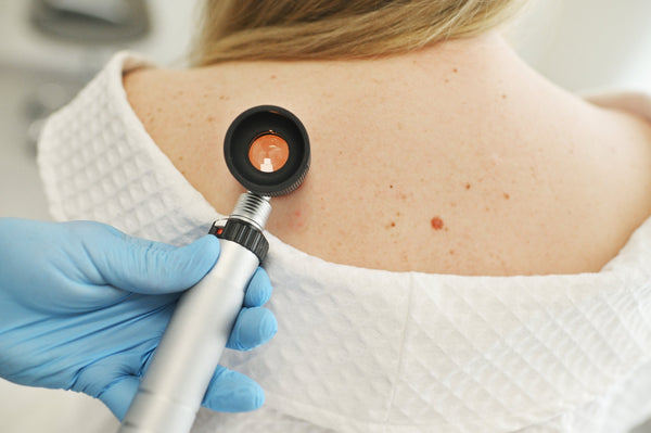 different types of skin cancer