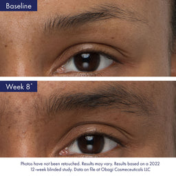 Before and after comparison of a person's eye with text indicating a 12-week study by Obagi Cosmeceuticals LLC.