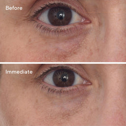 Murad Targeted Eye Depuffer