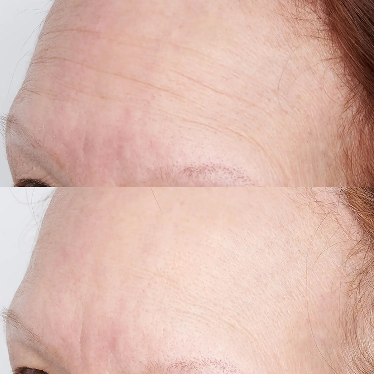 before and after