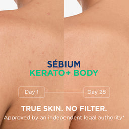 Bioderma Sebium Kerato+ Body Spray 150ml