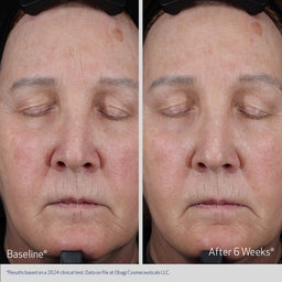 Obagi Elastiderm Lift Up & Sculpt Facial Moisturiser