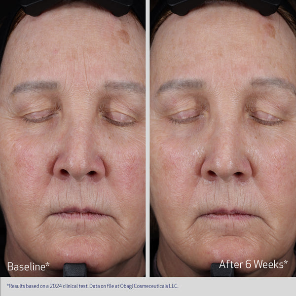 Obagi Elastiderm Lift Up & Sculpt Facial Moisturiser
