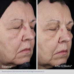 Obagi Elastiderm Lift Up & Sculpt Facial Moisturiser