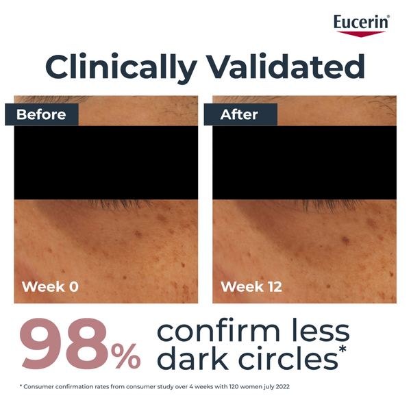 Eucerin Anti-Pigment Dark Circle Eye Corrector 15ml