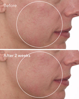 Cellular Hydration Barrier Repair Cream