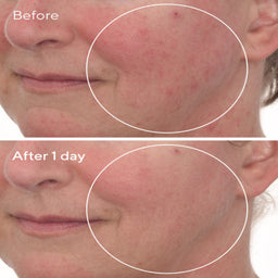 Murad Cellular Hydration Barrier Repair Mask