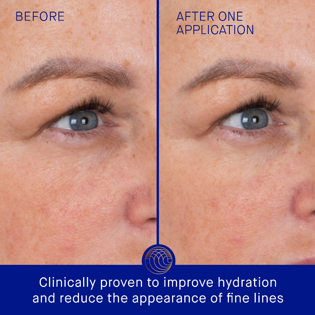 Before and after comparison of skin hydration with a blue border and text.