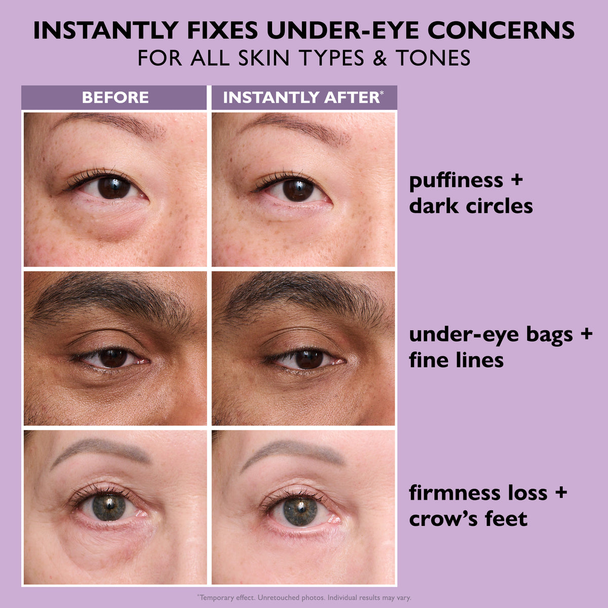 Peter Thomas Roth Instant FIRMx® Temporary Eye Tightener Easy-Wear Formula