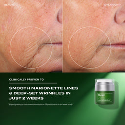 Before and after comparison of marionette lines and deep-set wrinkles with a Murad skincare product.