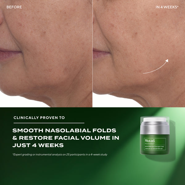 Before and after comparison of facial skin with a Murad skincare product container.