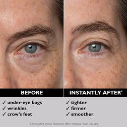 Peter Thomas Roth FIRMx Eye Duo Set (Worth £78.20)