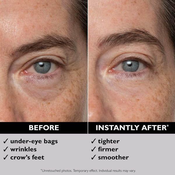 Peter Thomas Roth FIRMx Eye Duo Set (Worth £78.20)