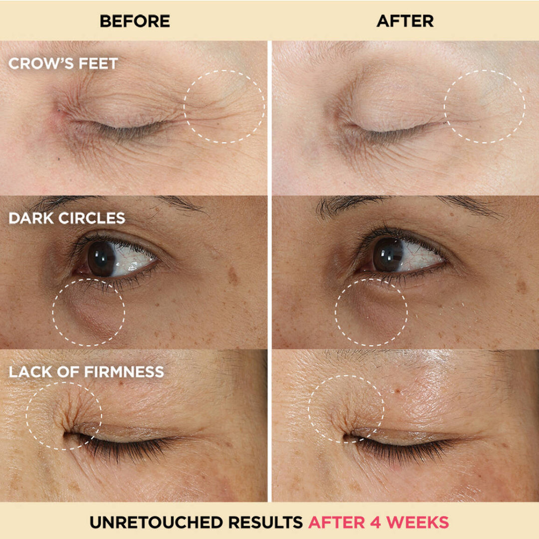 iT Cosmetics Confidence in an Eye Cream Anti-Aging Peptide Eye Cream 15ml
