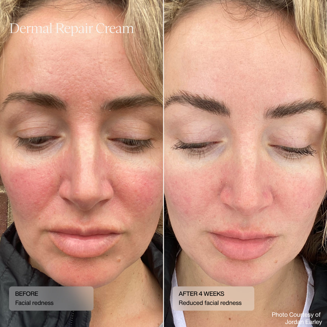 Senté Dermal Repair Kit