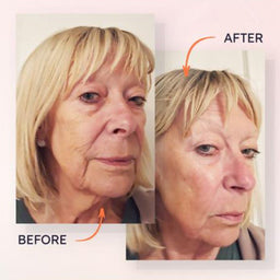 augustinus-bader-the-hydrogel-face-mask