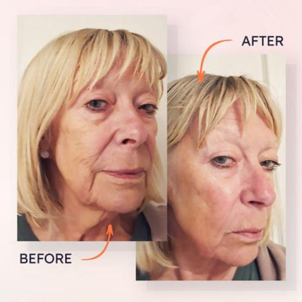 augustinus-bader-the-hydrogel-face-mask