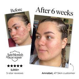 47 Skin Anti-Blemish and Scar Repair Serum 15ml