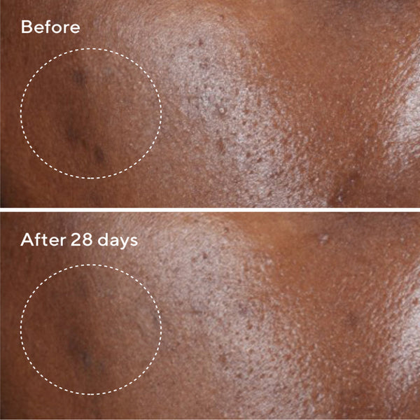 Murad Rapid Dark Spot Correcting Serum