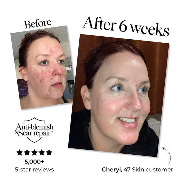 47 Skin Silver Mask 30ml