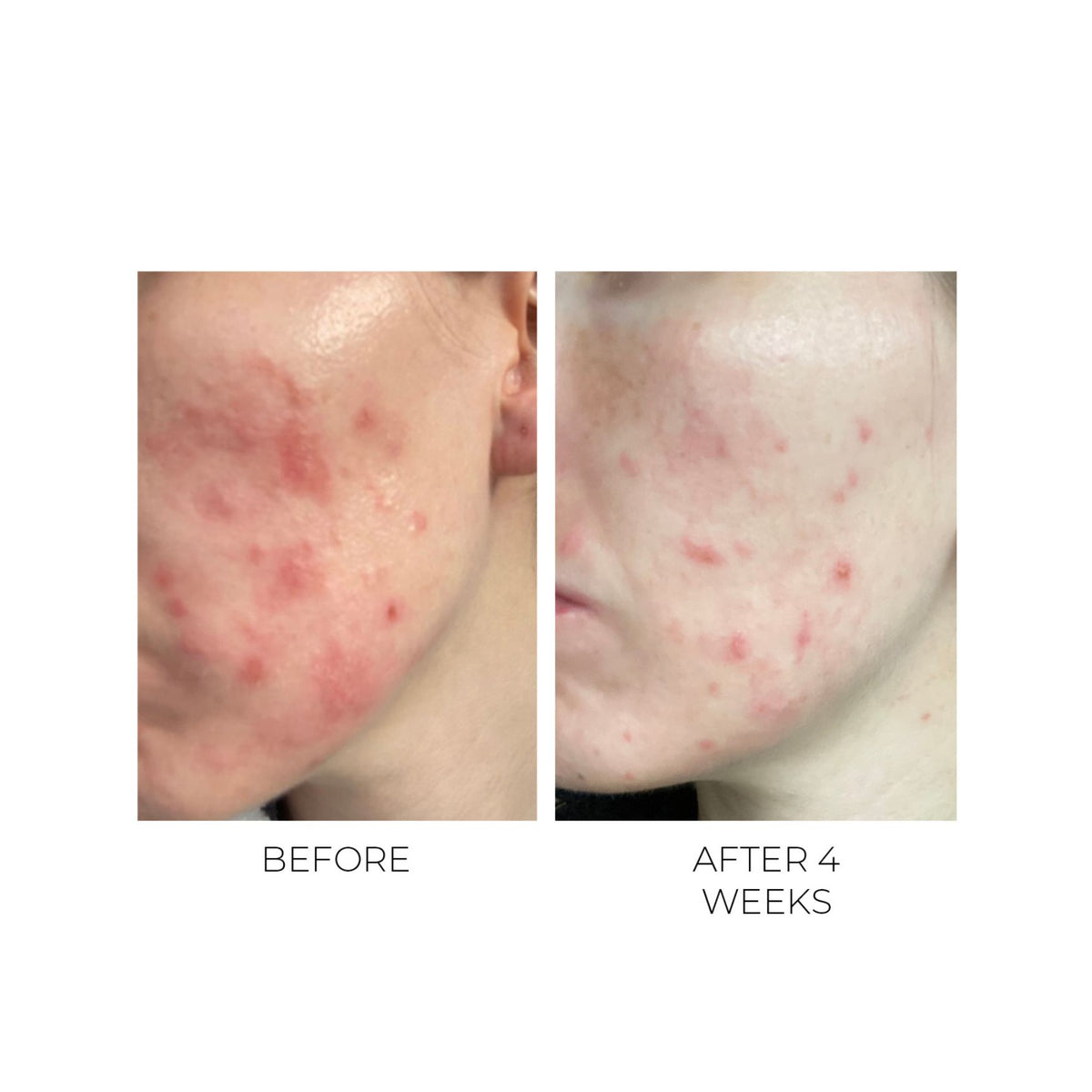 OSKIA Violet Water Clearing Cleanser