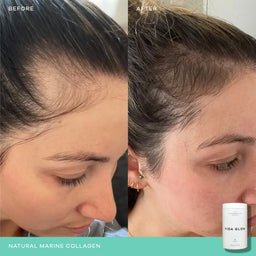 Vida Glow Natural Marine Collagen Caddy