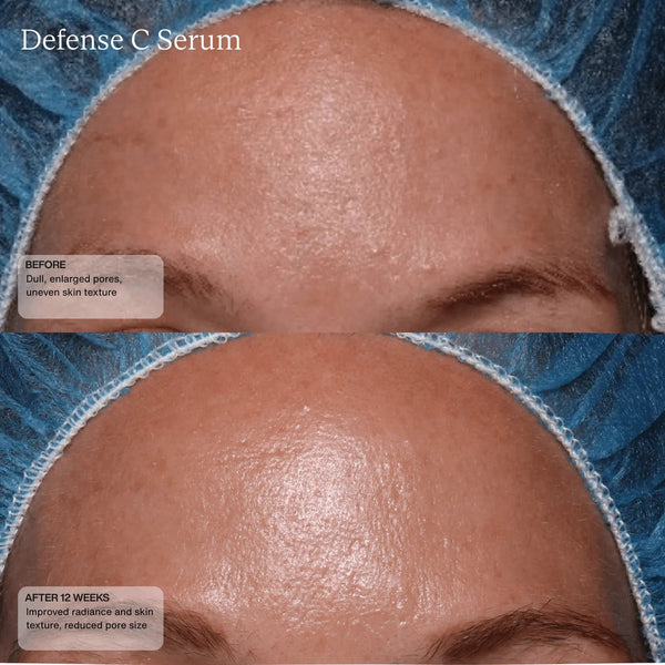 Senté Defense C Serum