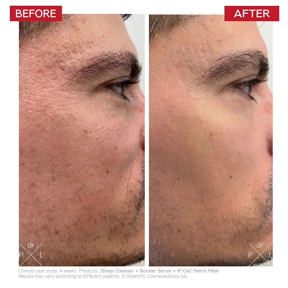 Before and after using the product