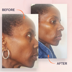 augustinus-bader-the-hydrogel-face-mask