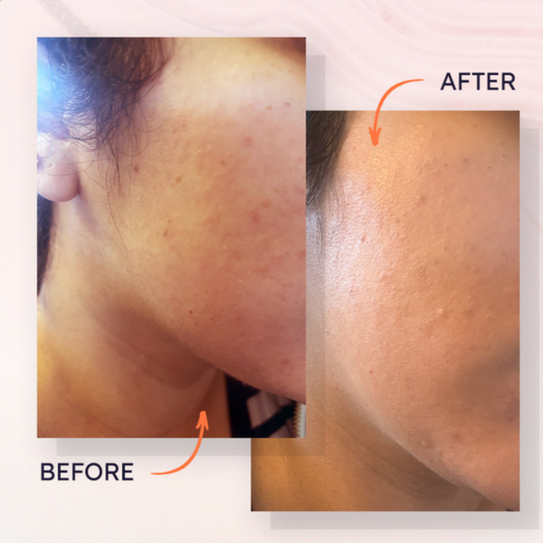 augustinus-bader-the-hydrogel-face-mask