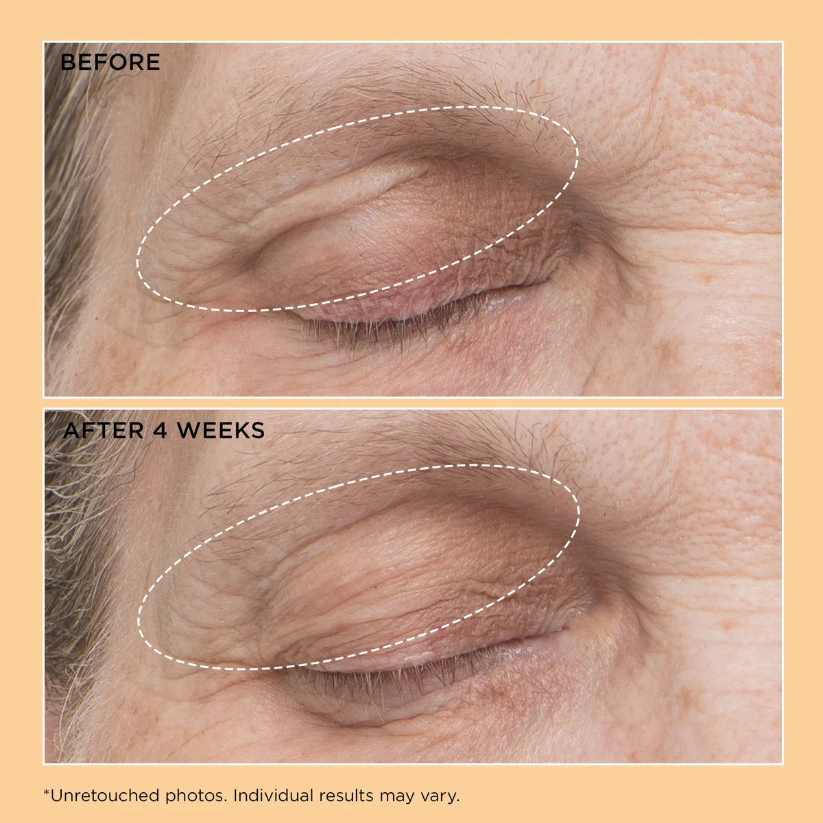 Perricone MD Neuropeptide Eyelid Lift Serum 15ml