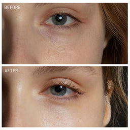 Freebie: FOREO FAQ Microneedling Anti-Wrinkle Hyaluronic Acid Patches For Under Eyes