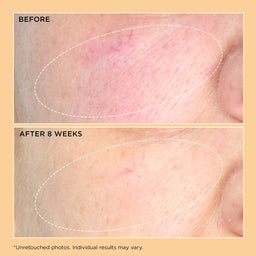 Perricone MD Neuropeptide Pro-Strength Firming Moisturizer 59ml