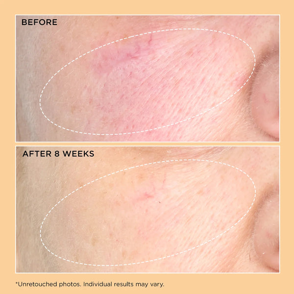 Perricone MD Neuropeptide Pro-Strength Firming Moisturizer 59ml