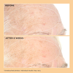 Perricone MD Neuropeptide Pro-Strength Firming Moisturizer 59ml