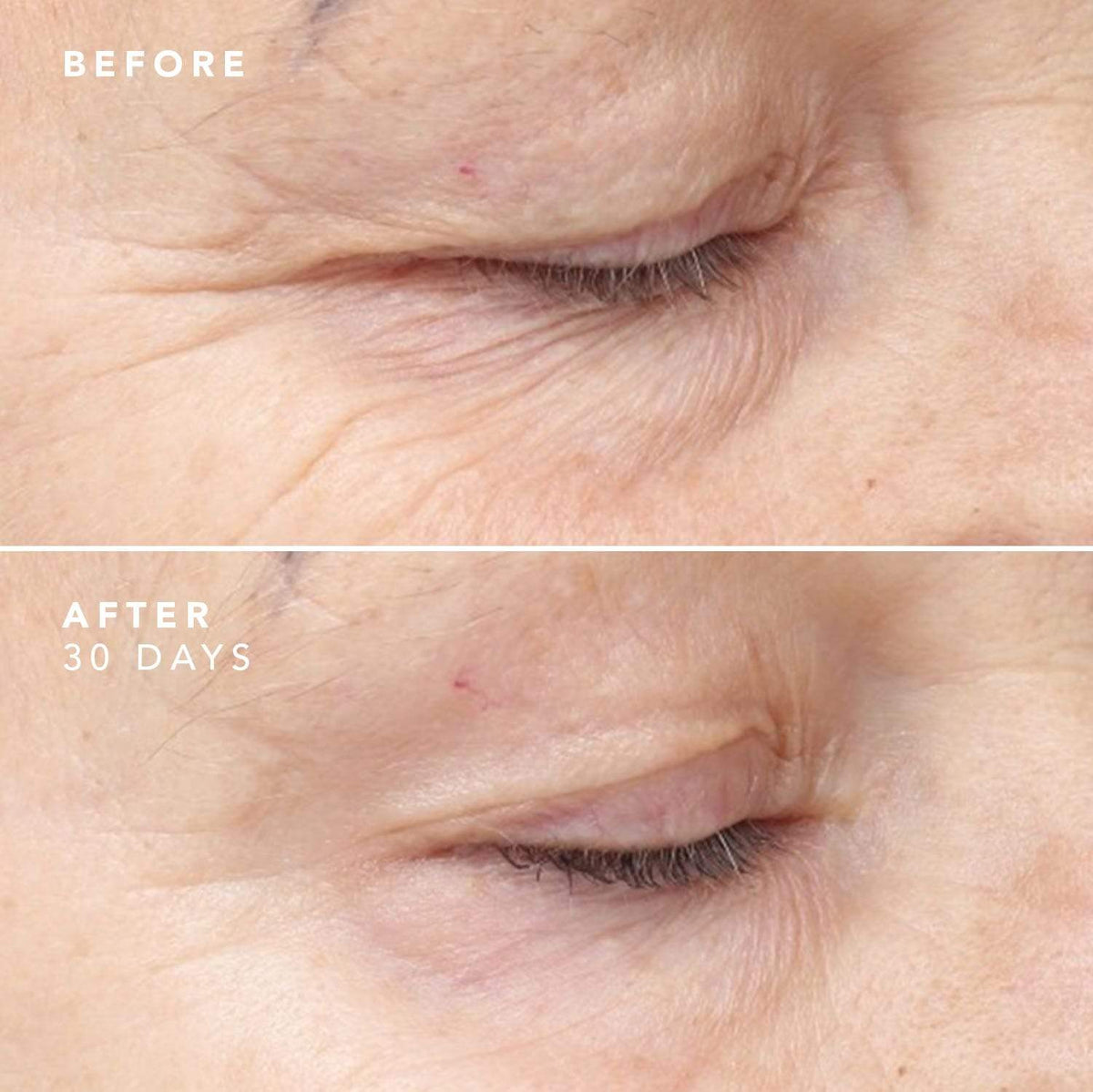 before and after