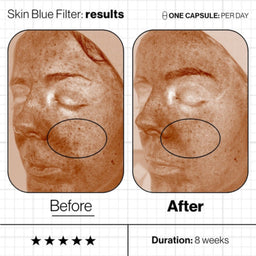 Before and after of Advanced Nutrition Programme Skin Blue Filter